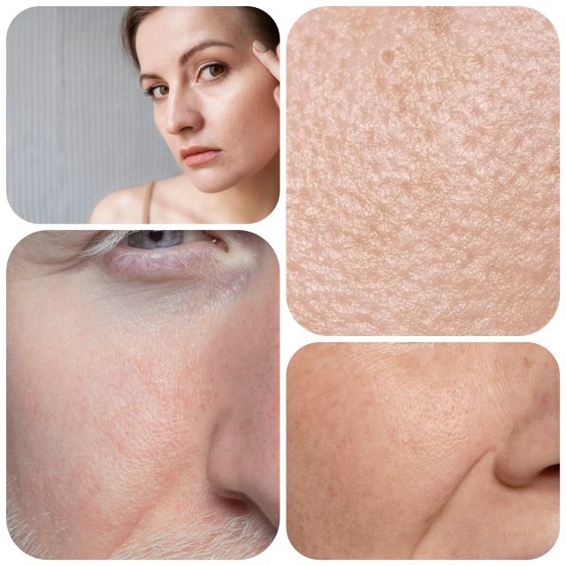 مرکز رفع مشکلات پوستی در شیراز