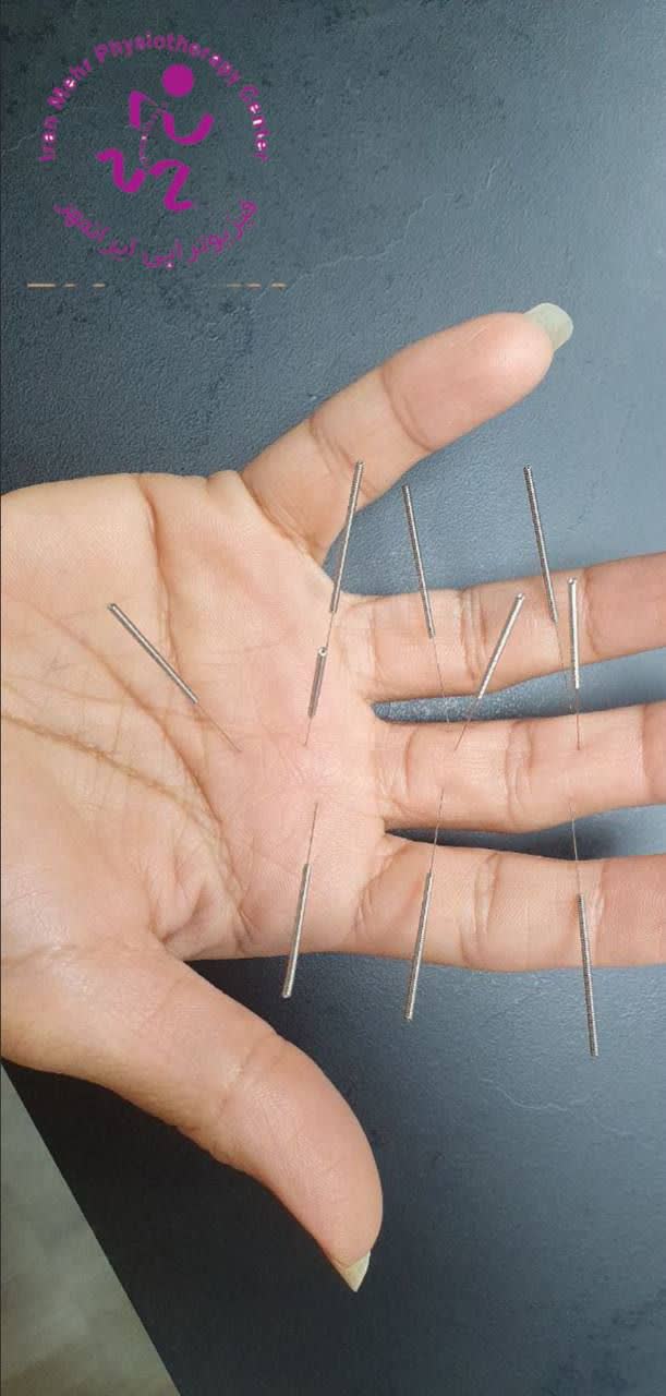 نمونه کار طب سوزنی درمهرشهر