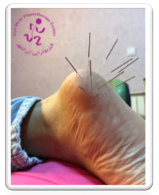 بهترین مرکز طب سوزنی مهرشهر