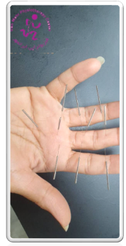 طب سوزنی ایرانمهر