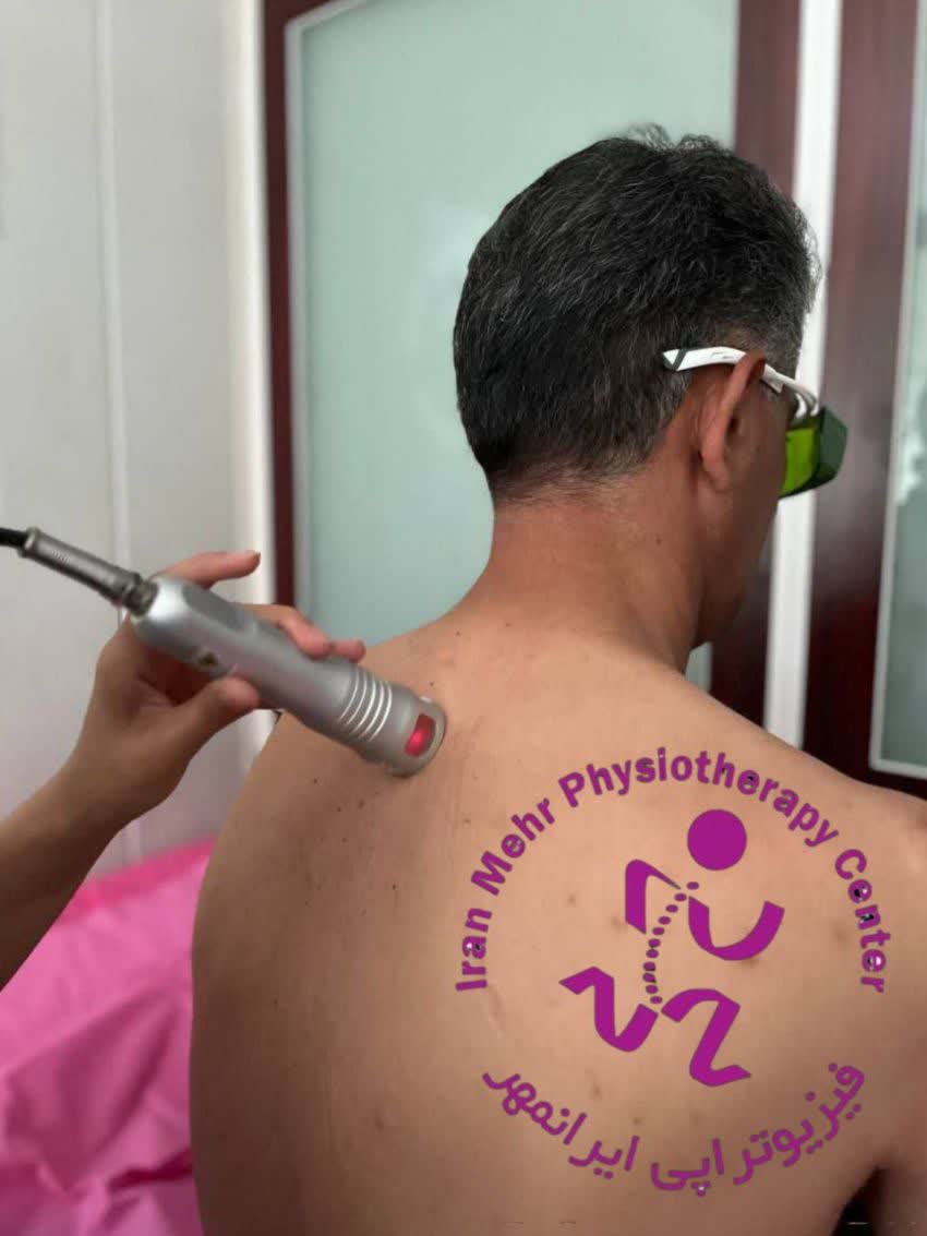 لیزر پرتوان