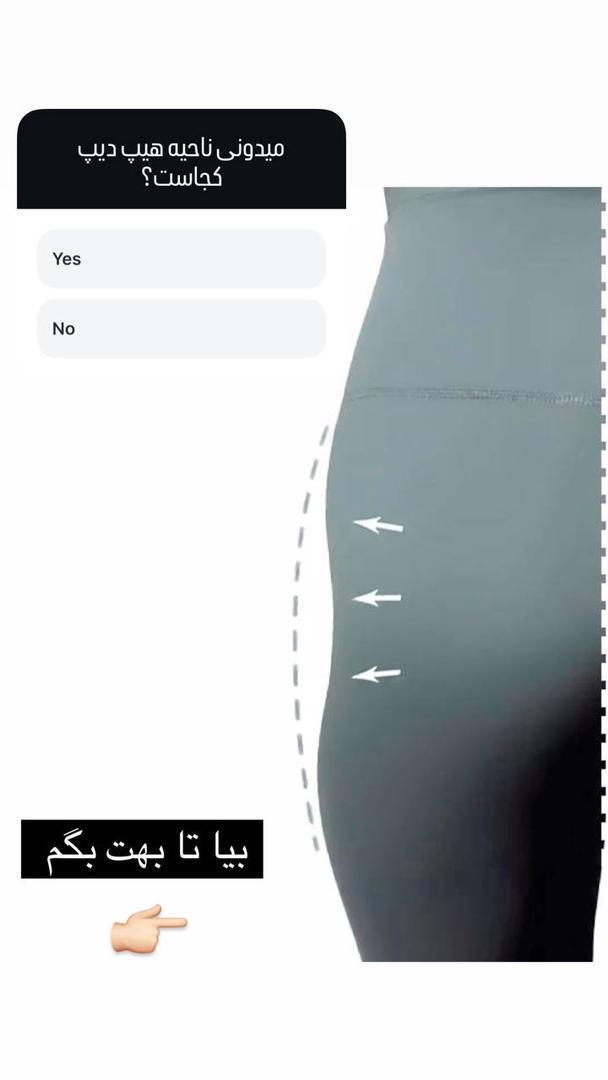 فیلرباسن تهران