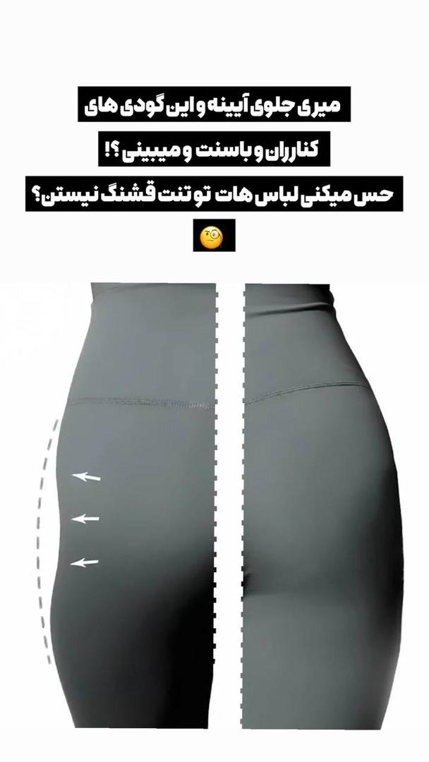 فیلرباسن تهران