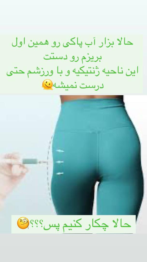 فیلرباسن تهران