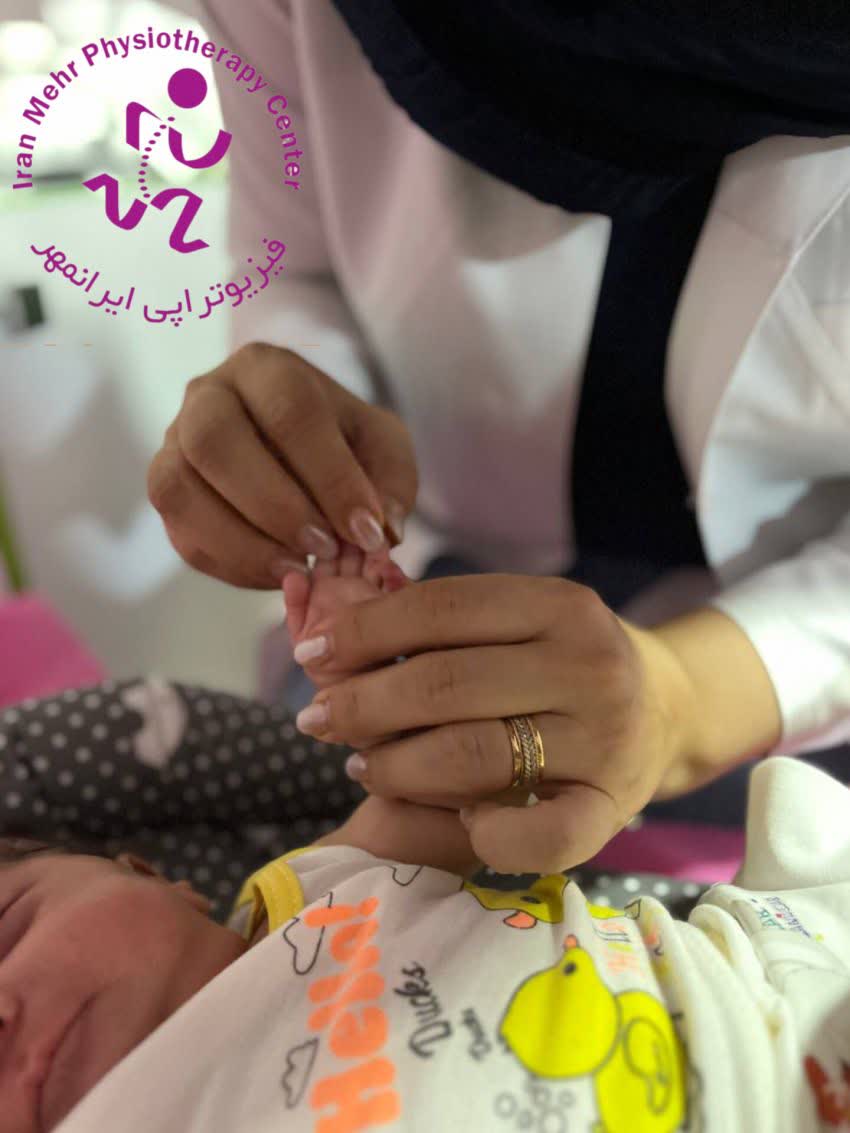 افزایش دامنه حرکتی انگشتان دنبال نقص مادرزادی