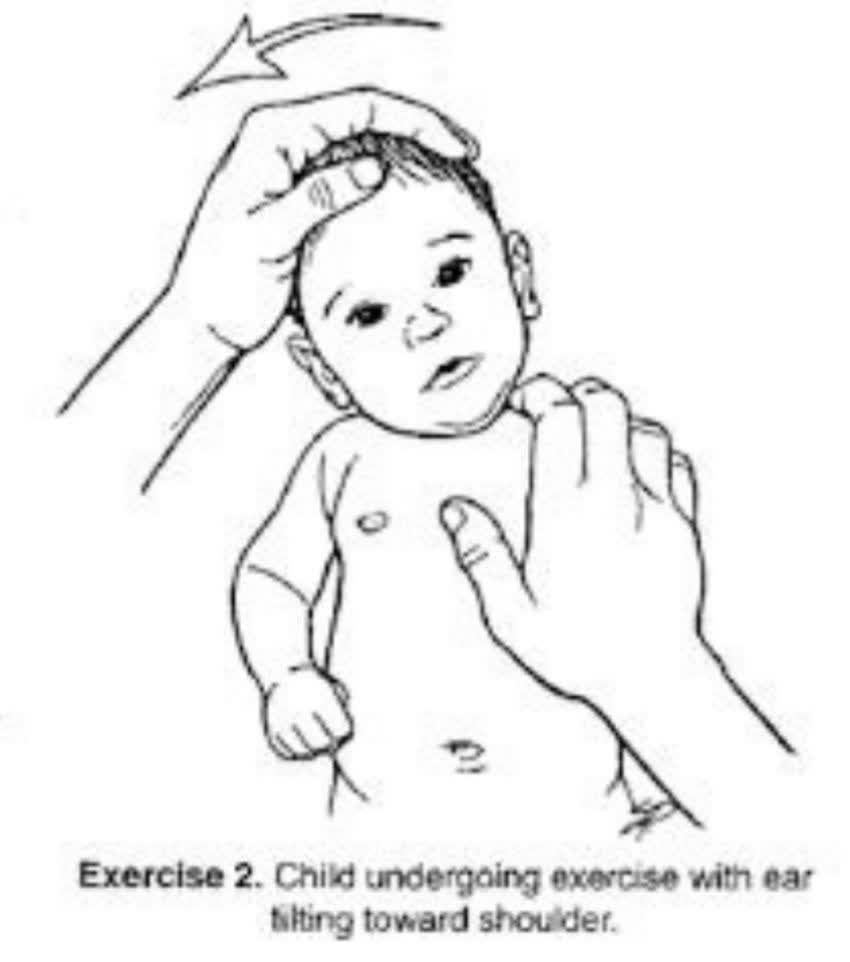 فیزیوتراپی کودکان در کرج