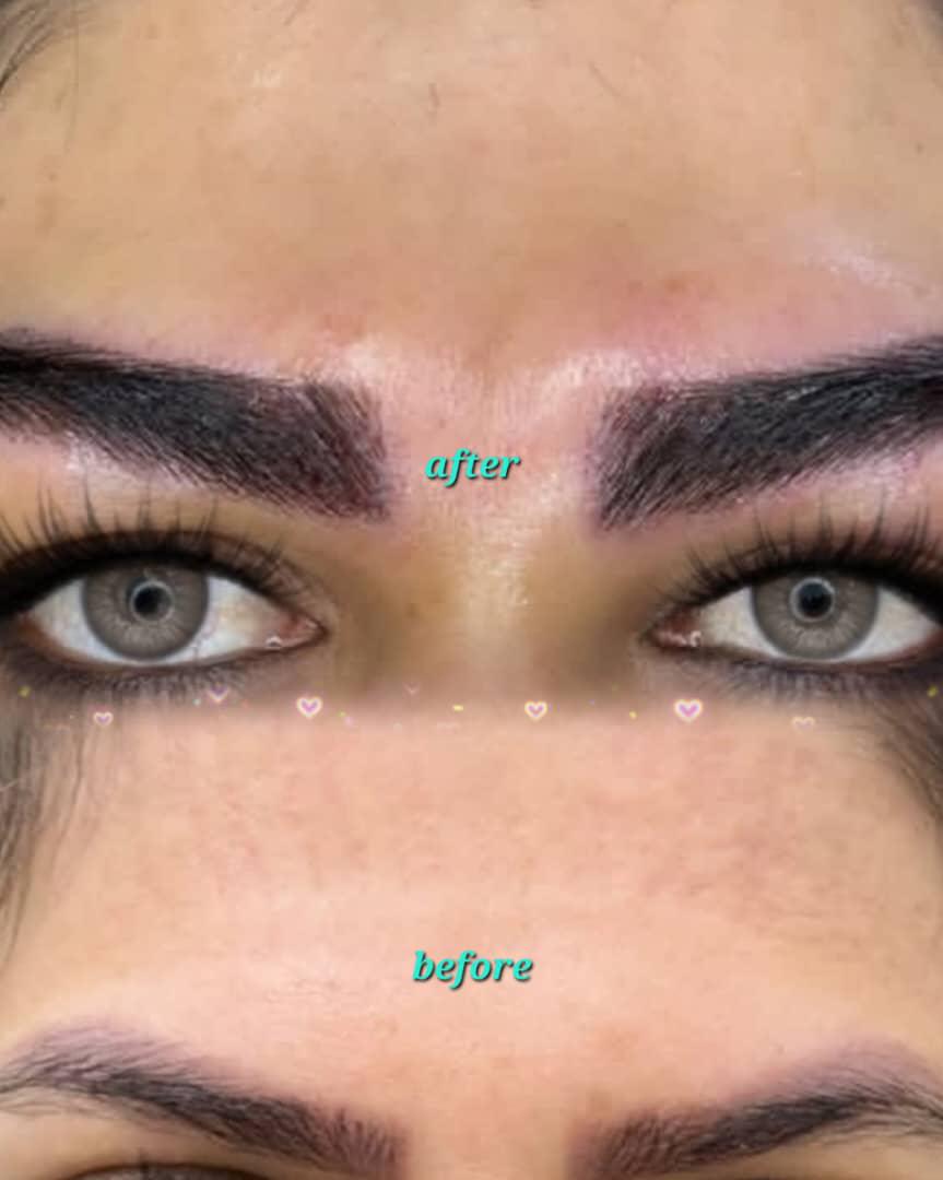 دلایل تدوام کاشت ابرو