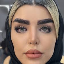 تروما یا آسیب به ناحیه کاشت