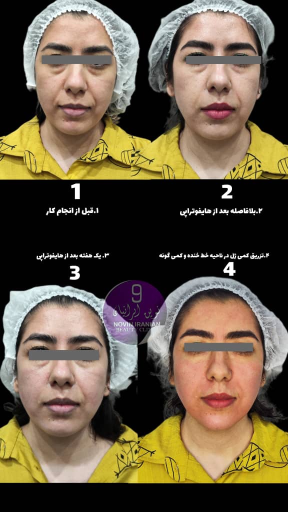 کلینیک زیبایی نوین ایرانیان