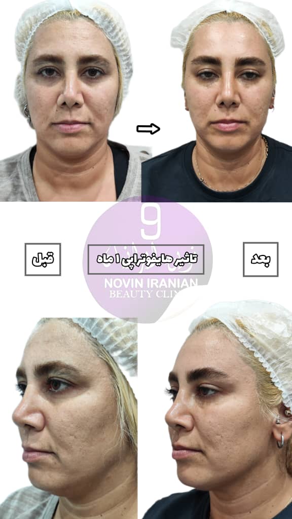 کلینیک زیبایی نوین ایرانیان