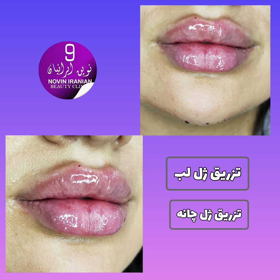 کلینیک زیبایی نوین ایرانیان