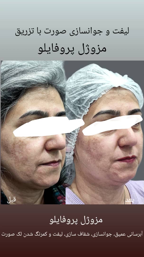 کلینیک زیبایی نوین ایرانیان