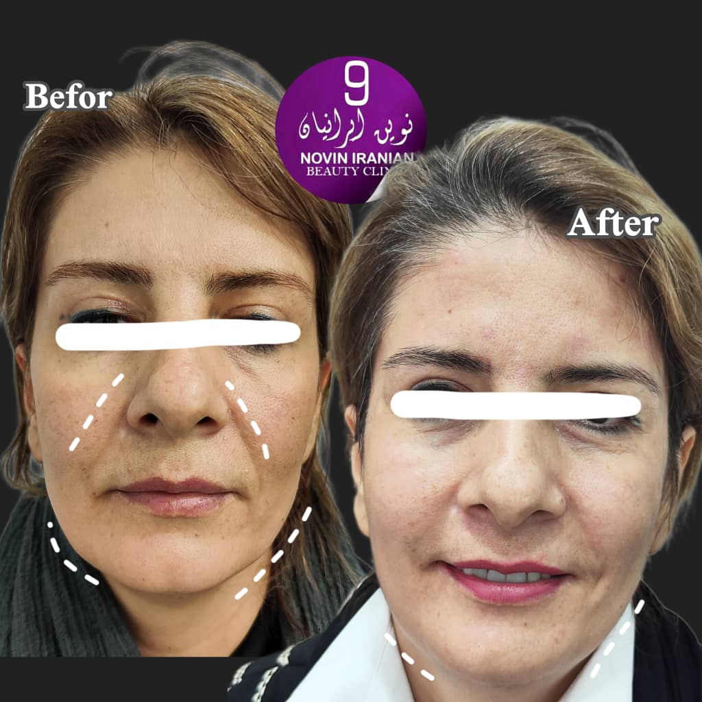 کلینیک زیبایی نوین ایرانیان