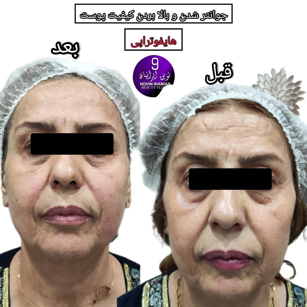 کلینیک زیبایی نوین ایرانیان