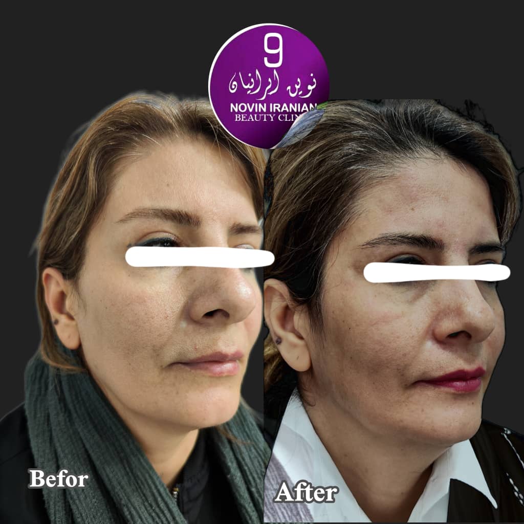 کلینیک زیبایی نوین ایرانیان