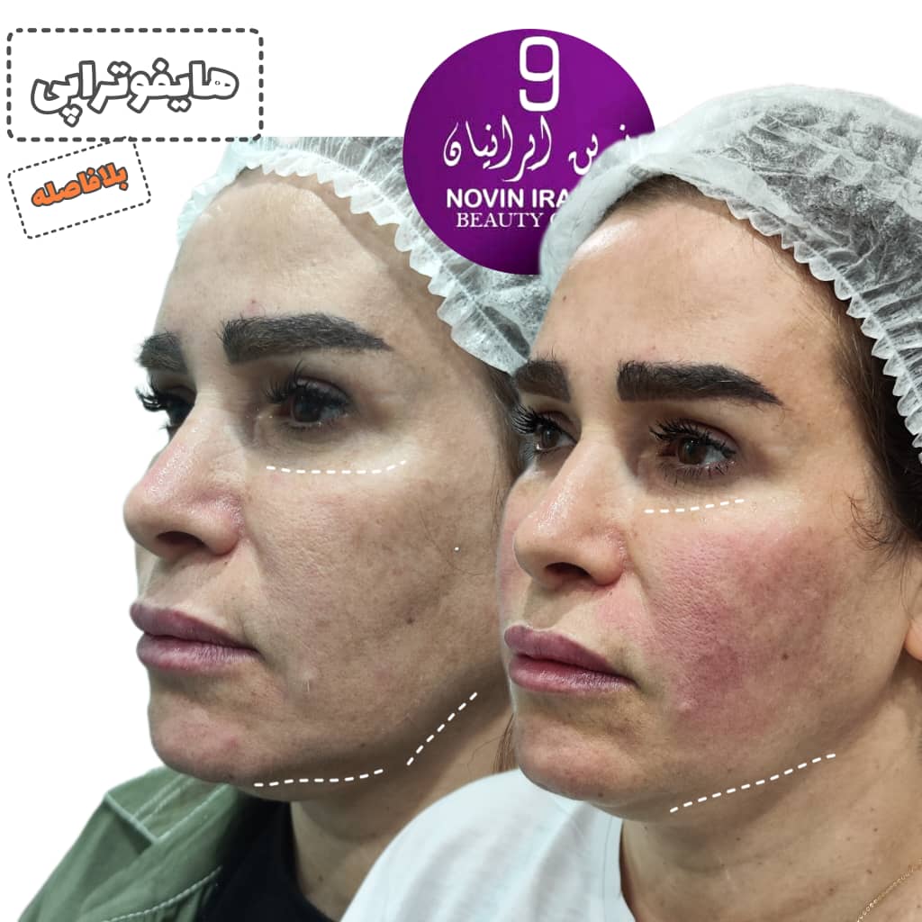 کلینیک زیبایی نوین ایرانیان
