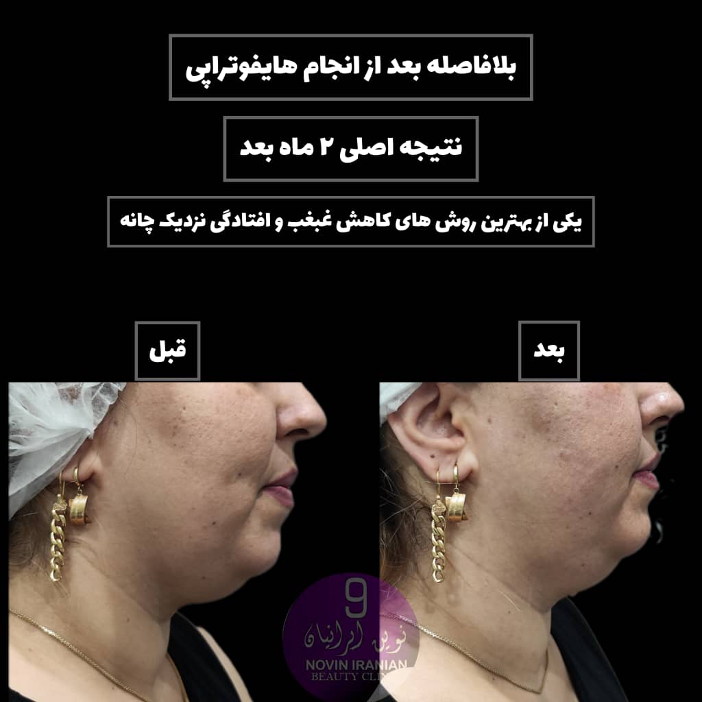 کلینیک زیبایی نوین ایرانیان