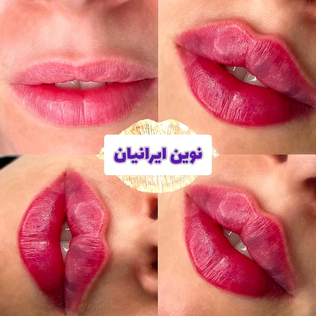 کلینیک زیبایی نوین ایرانیان