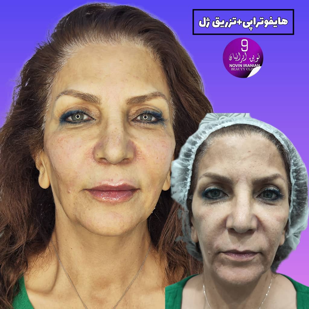 کلینیک زیبایی نوین ایرانیان