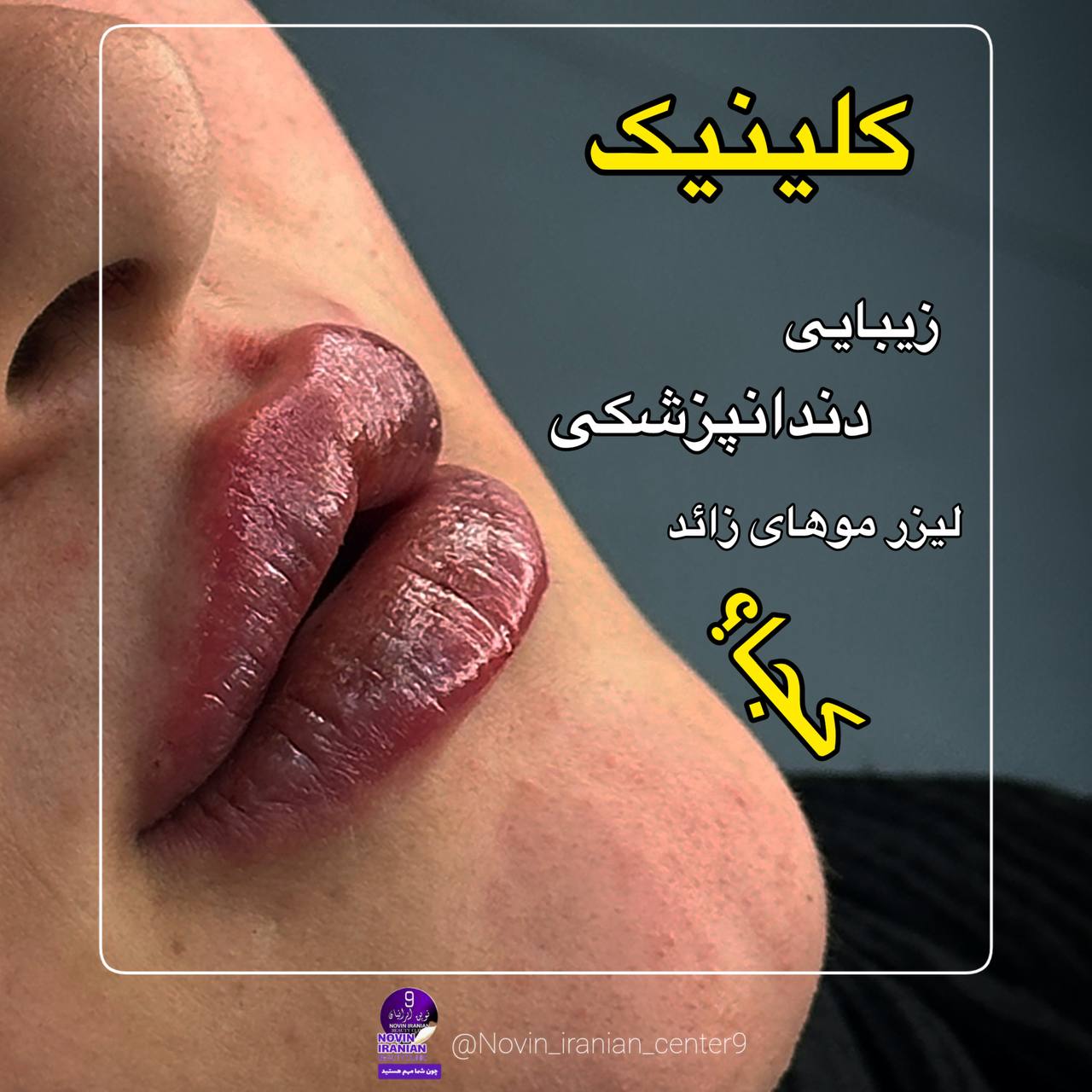 کلینیک زیبایی نوین ایرانیان