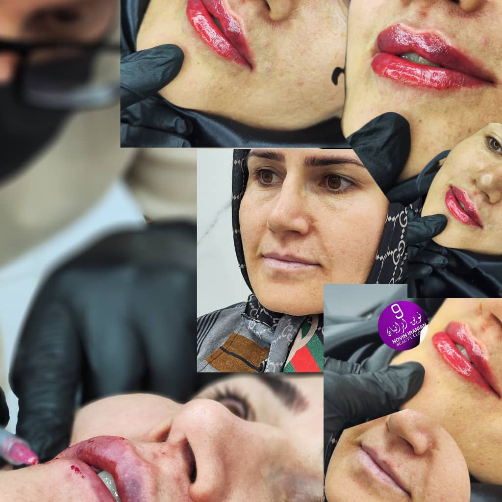 کلینیک زیبایی نوین ایرانیان