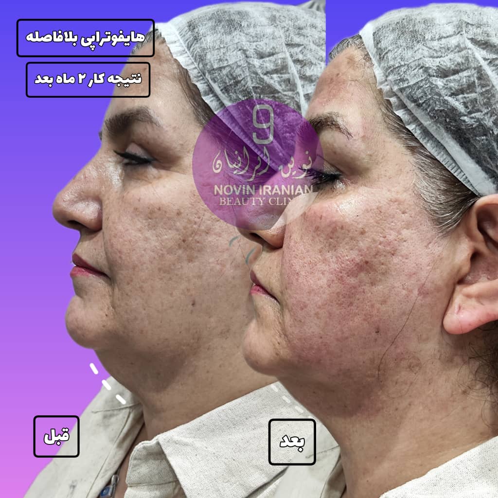کلینیک زیبایی نوین ایرانیان