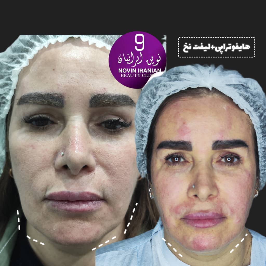 کلینیک زیبایی نوین ایرانیان