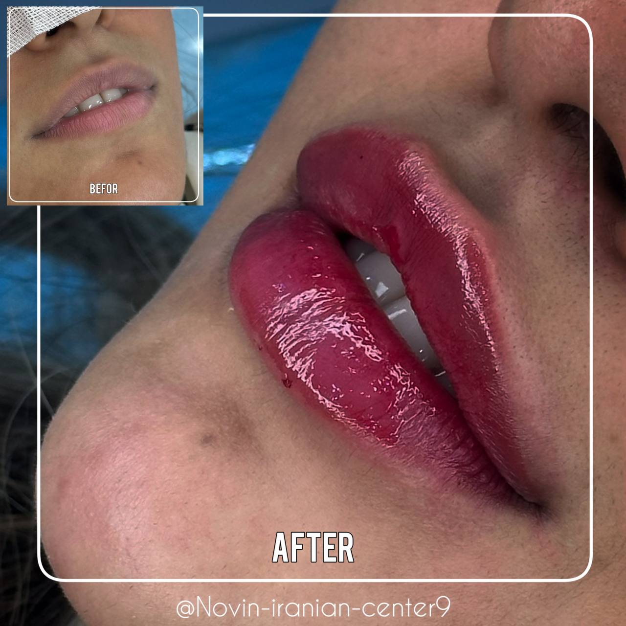 کلینیک زیبایی در مهرشهر