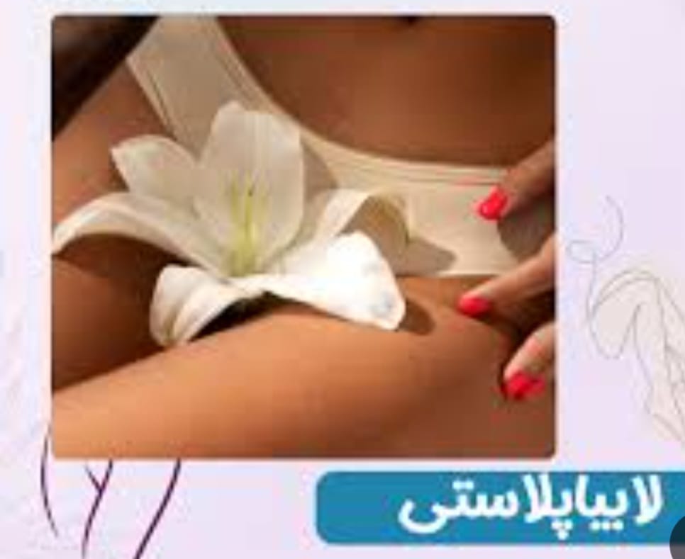 مرکز لابیاپلاستی بدون درد در خرم اباد