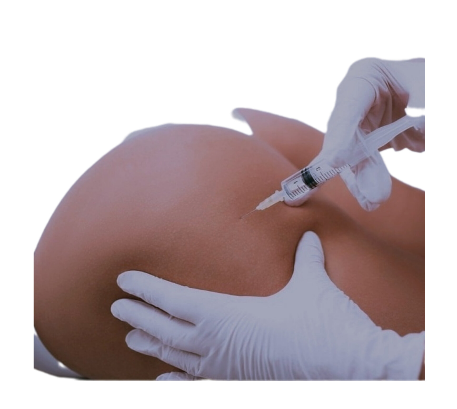 فیلر باسن در زاهدان