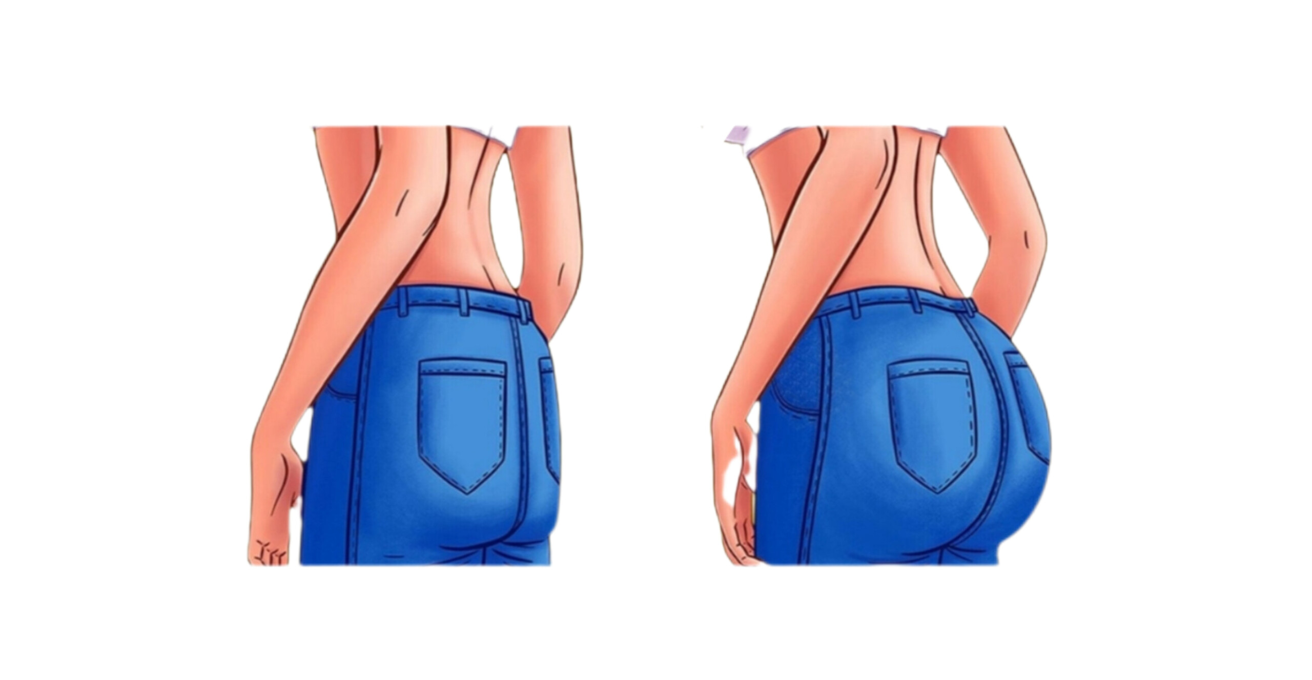 فیلر باسن در زاهدان