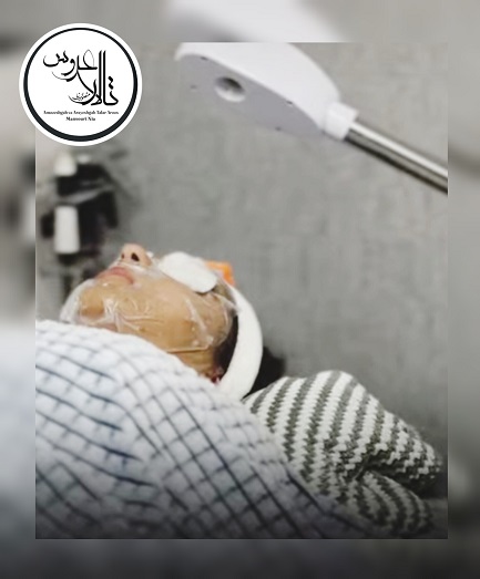 پاکسازی پوست در کرمان؛ تالار عروس منصوری نیا