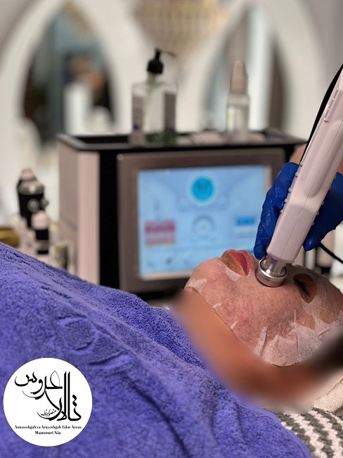 پاکسازی پوست در کرمان/ تالار عروس منصوری نیا