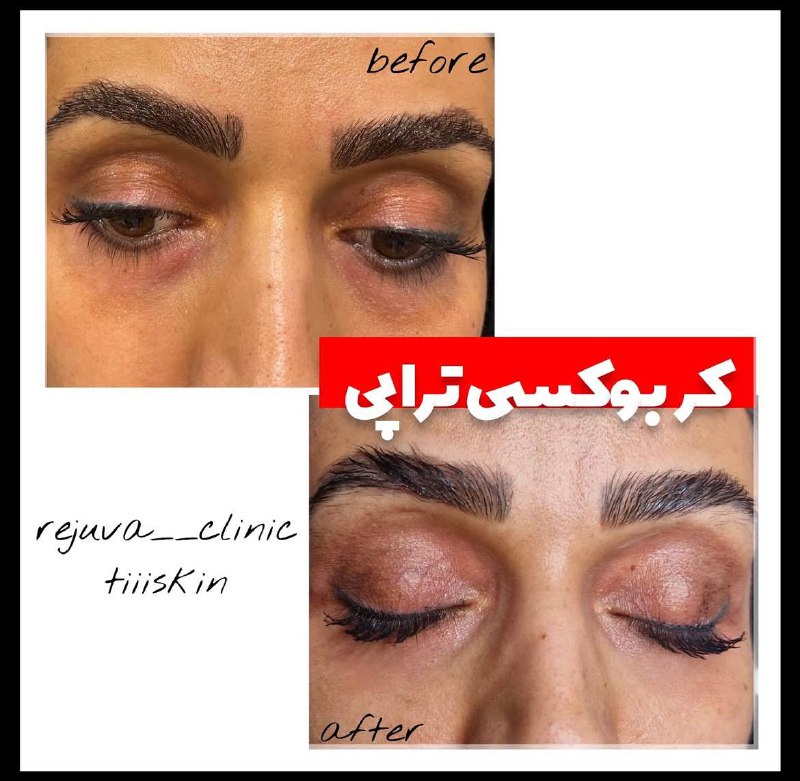 کلینیک زیبایی رژووا