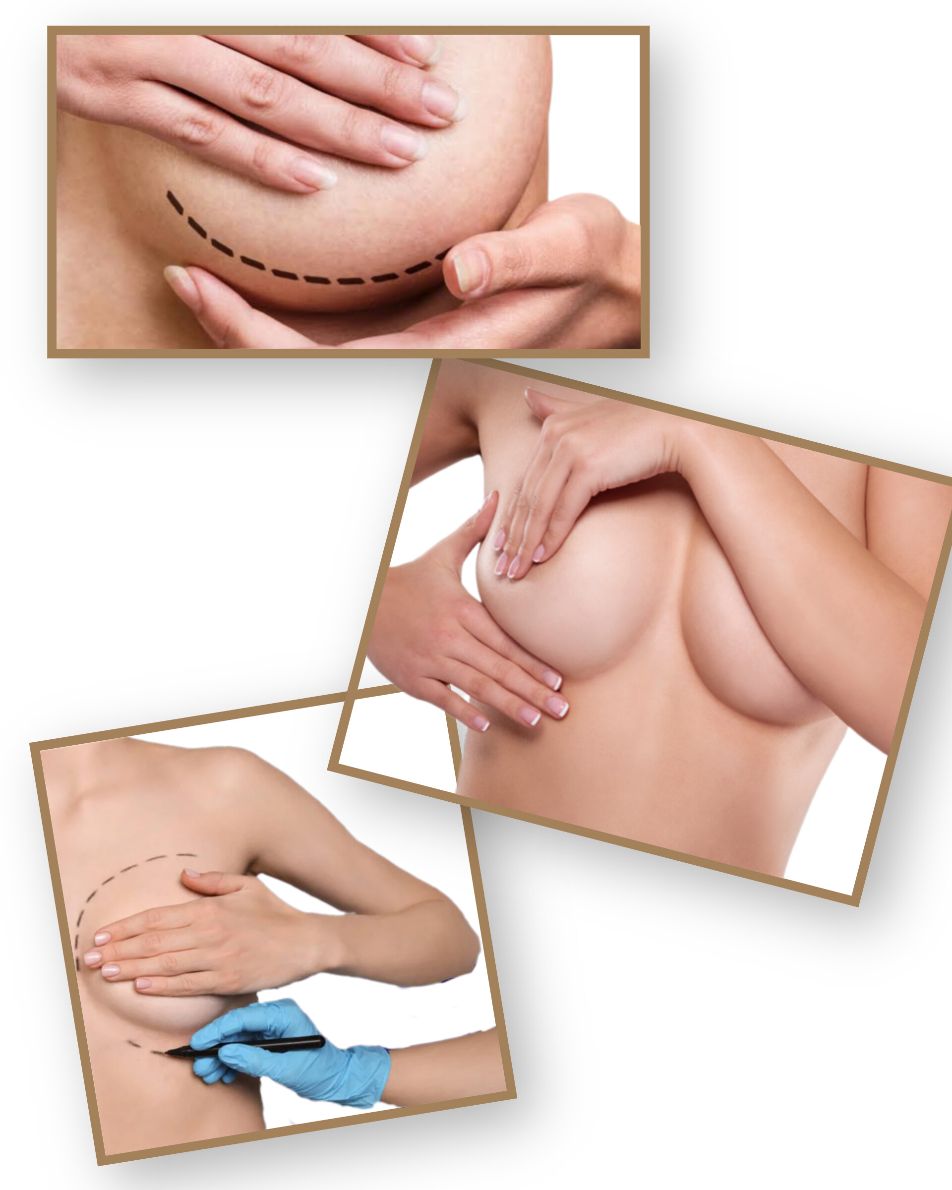 ماموپلاستی در زاهدان