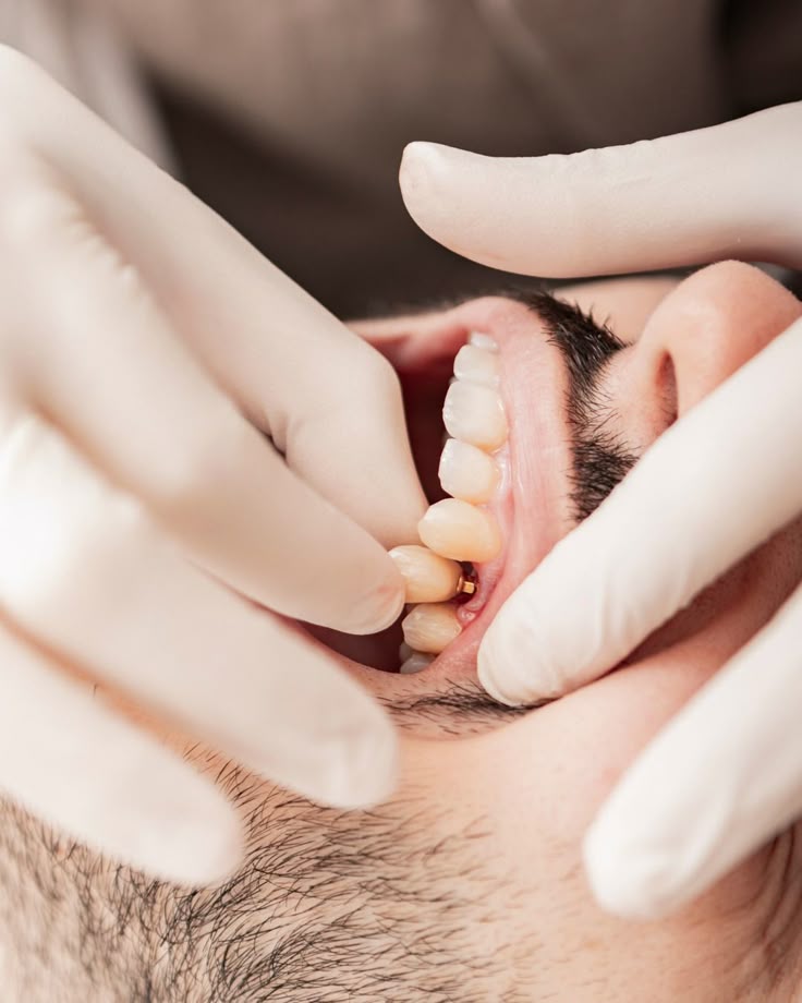 مرکز تخصصی ایمپلنت قسطی در فولادشهر