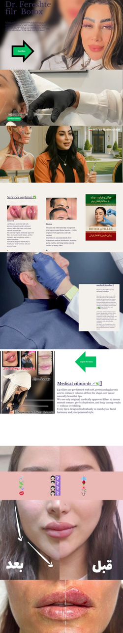 مرکز تخصصی فیلر و بوتاکس نسیم شهر
