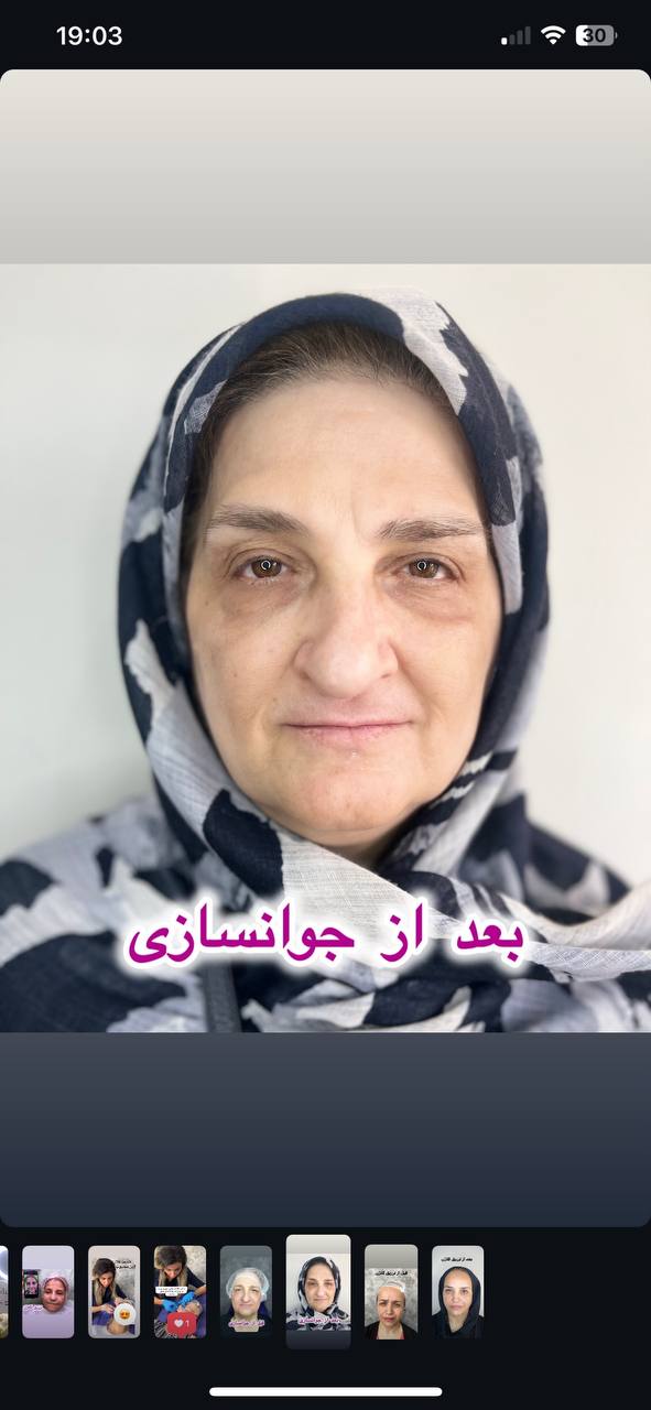 جوانسازی صورت غرب تهران