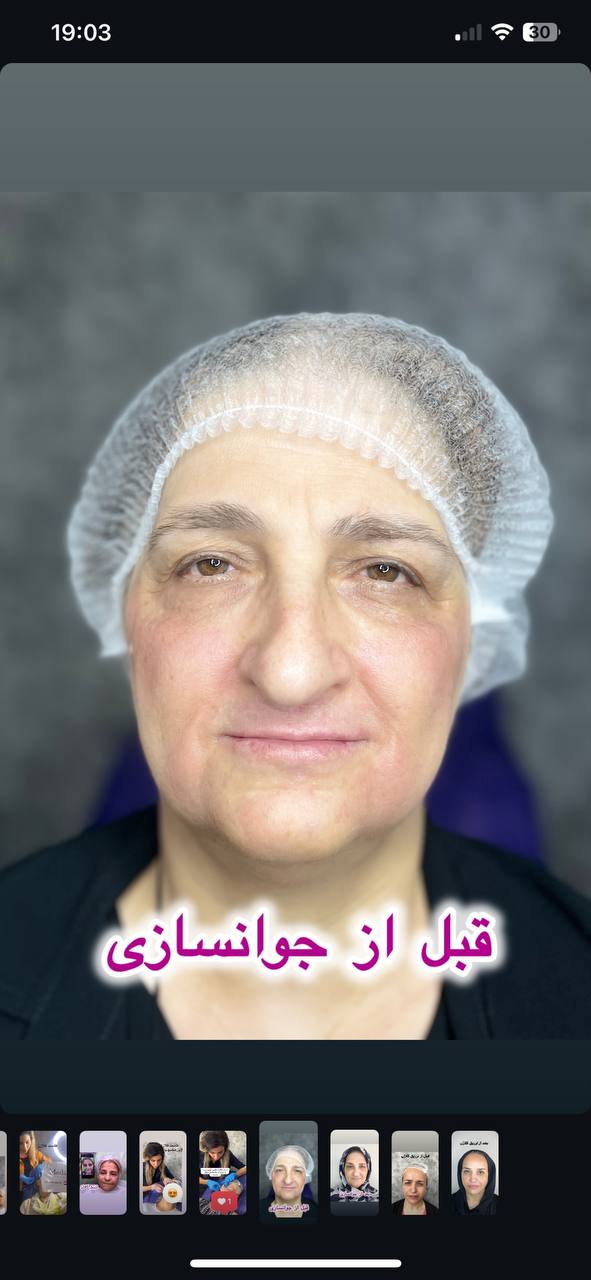 جوانسازی صورت غرب تهران