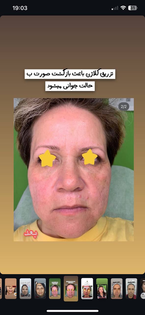 جوانسازی صورت غرب تهران