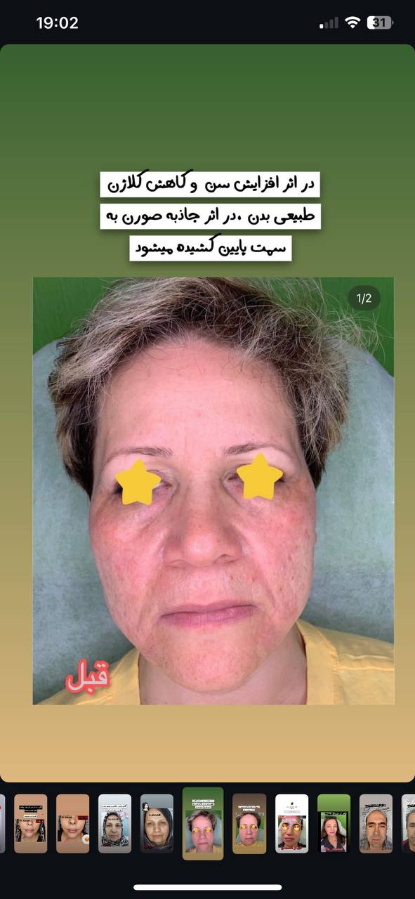 جوانسازی صورت غرب تهران