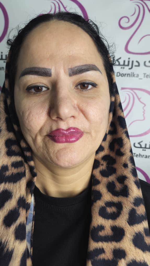 جوانسازی صورت غرب تهران