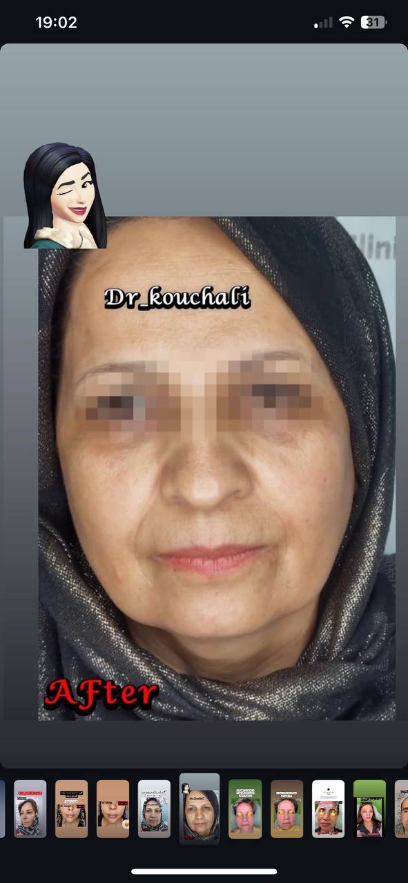 جوانسازی صورت غرب تهران