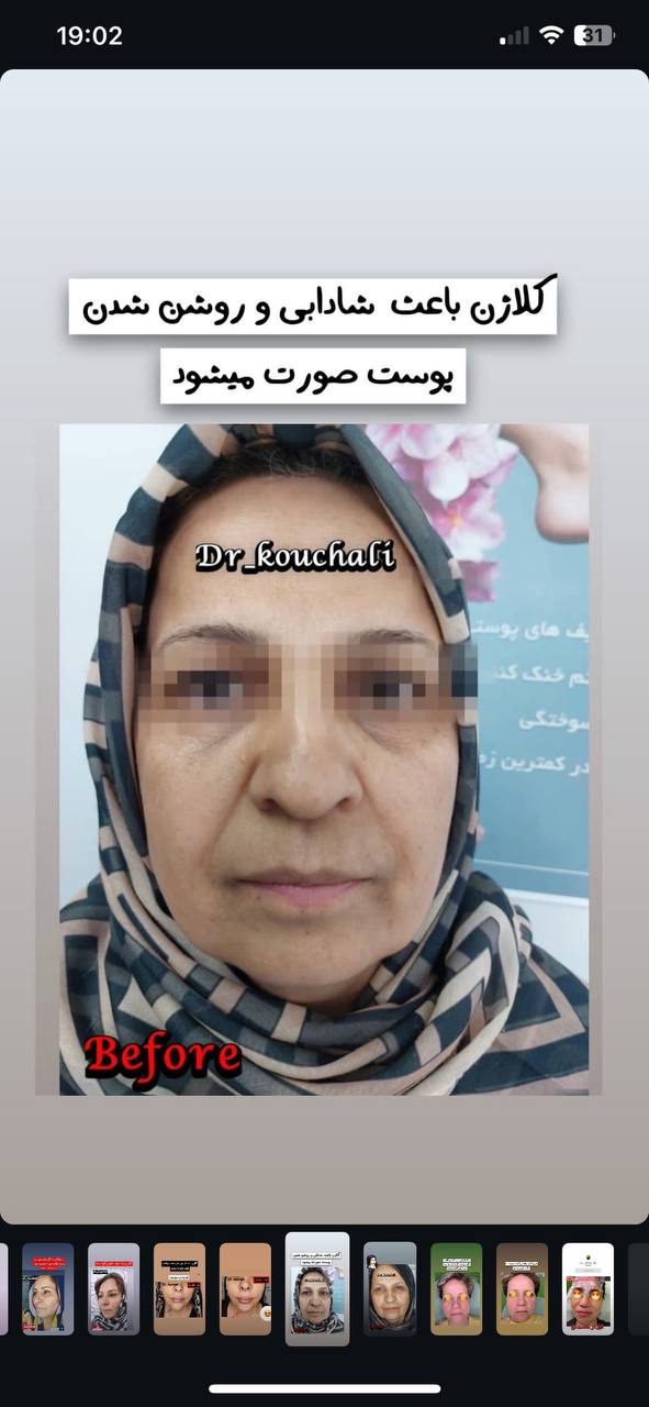 جوانسازی صورت غرب تهران