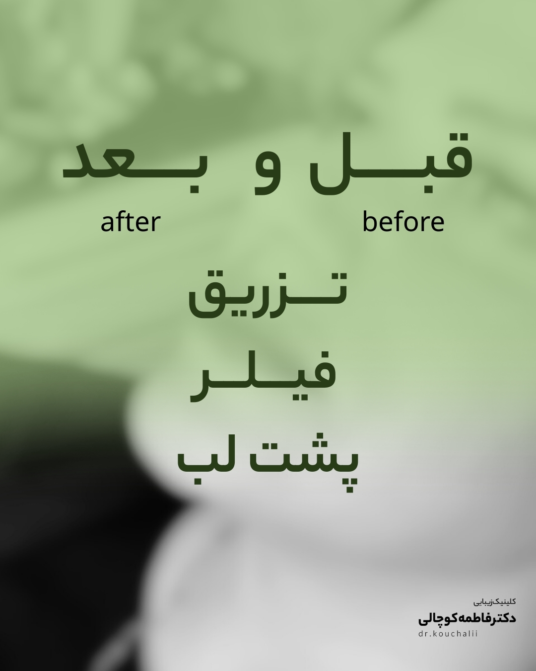 لب روسی صادقیه