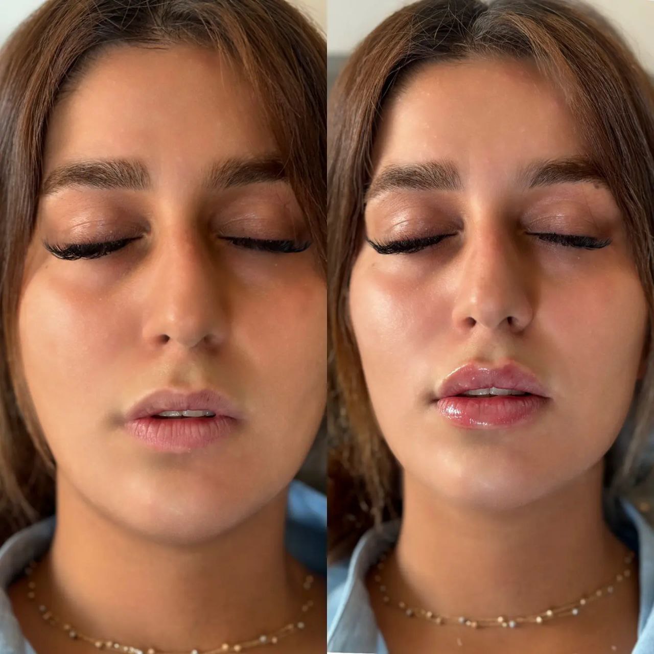 لب روسی صادقیه