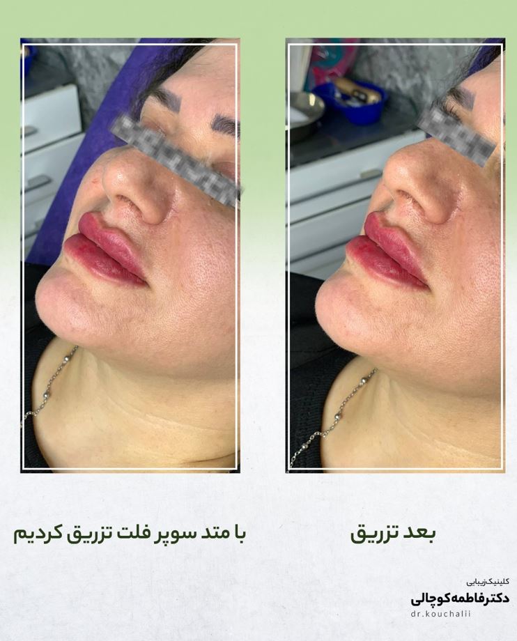 لب روسی صادقیه