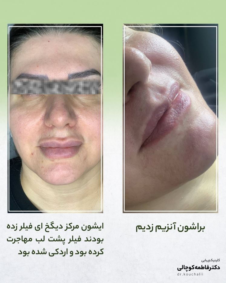 لب روسی صادقیه