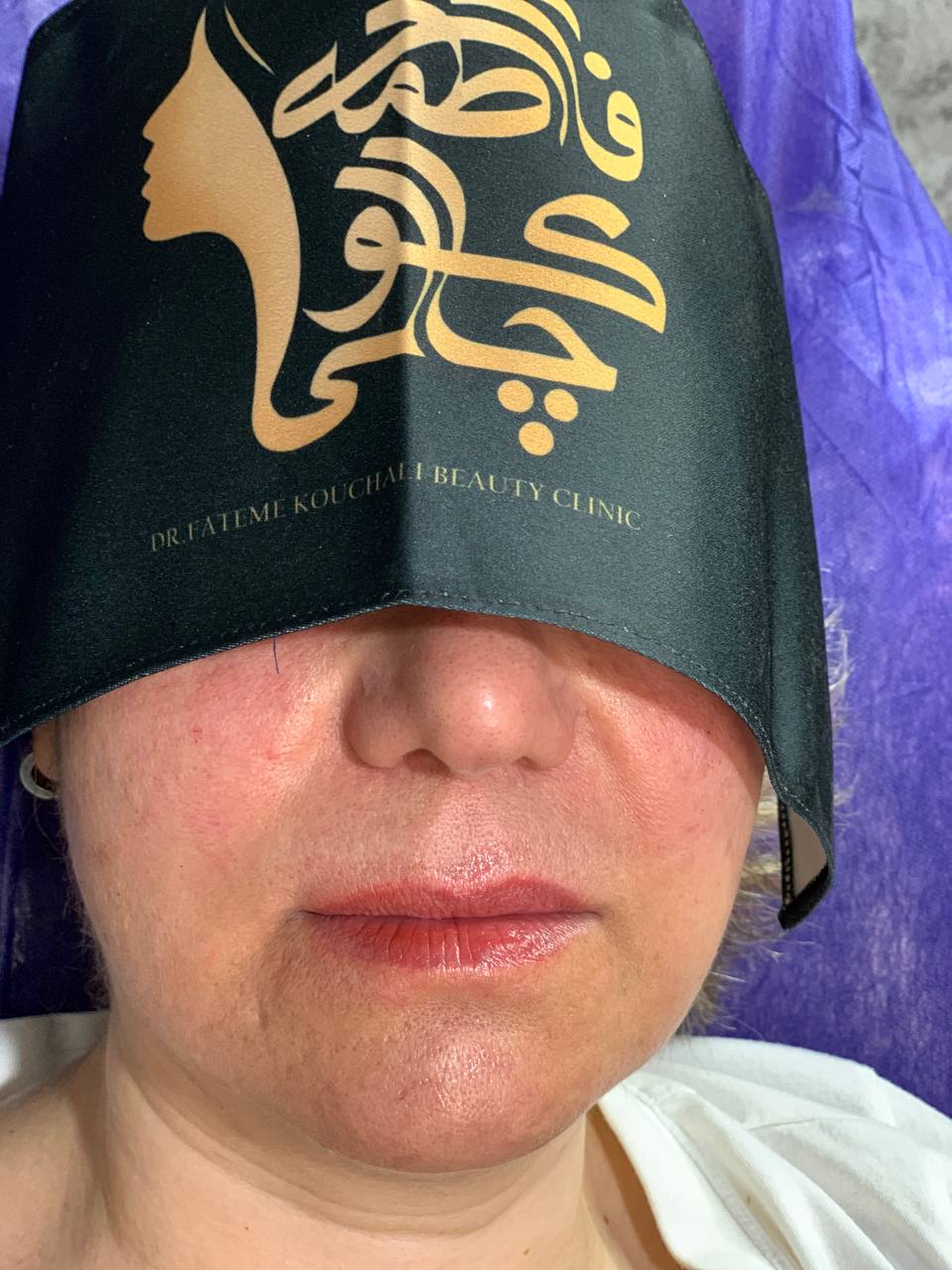 لب روسی صادقیه