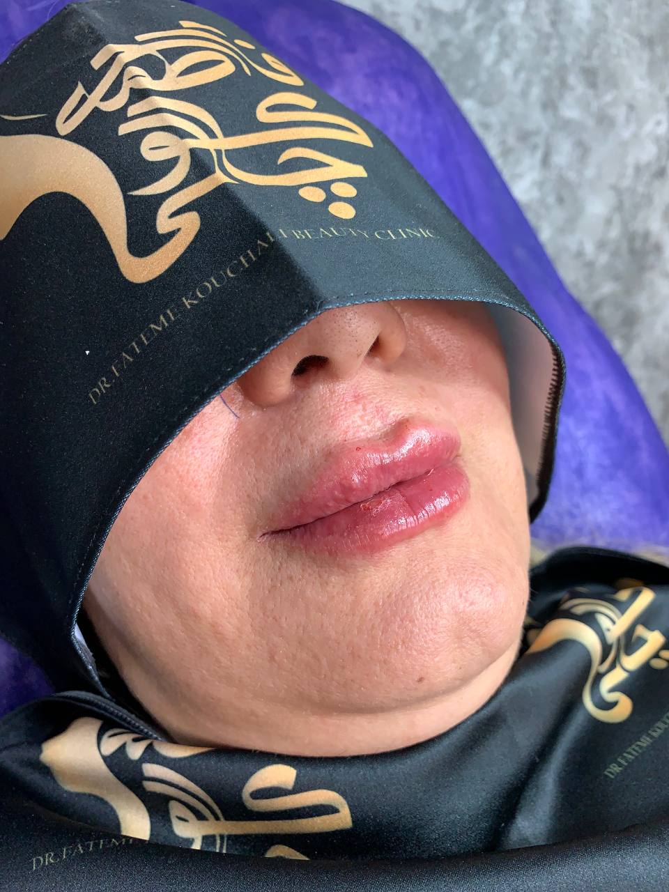 لب روسی صادقیه